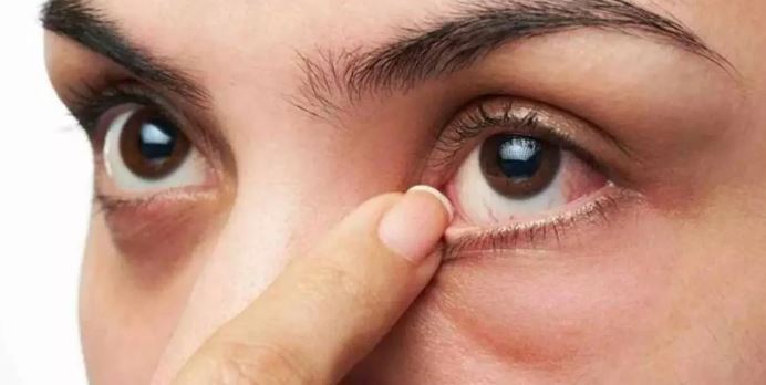 Göz Enfeksiyonuna Ne İyi Gelir? Evde Bitkisel Çözümler