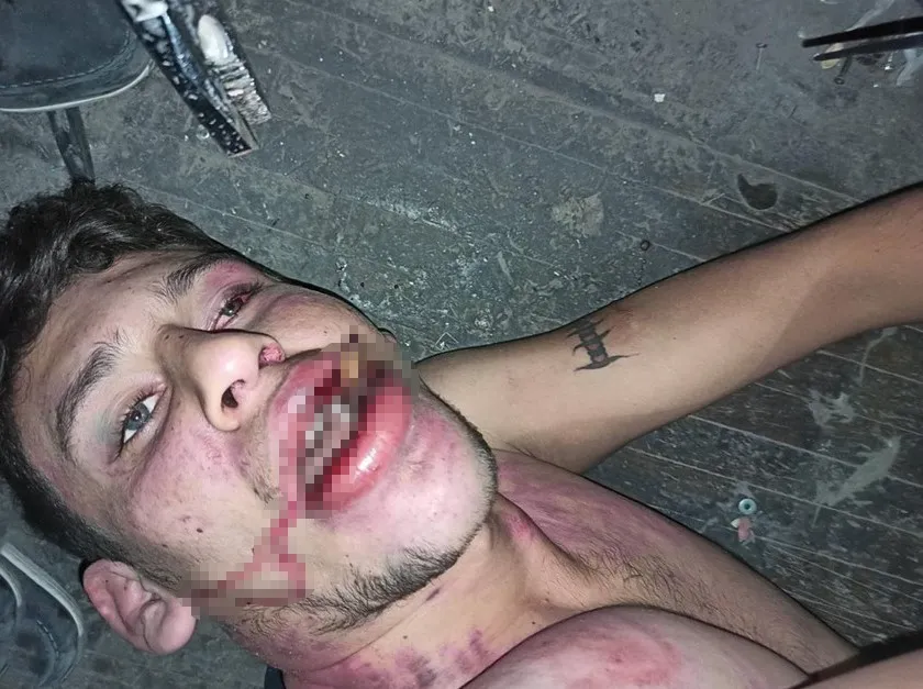 Antalya’daki İşkence Davasında Karar: Hürriyeti Tehdit Suçundan 6 Yıl 12 Ay Ceza