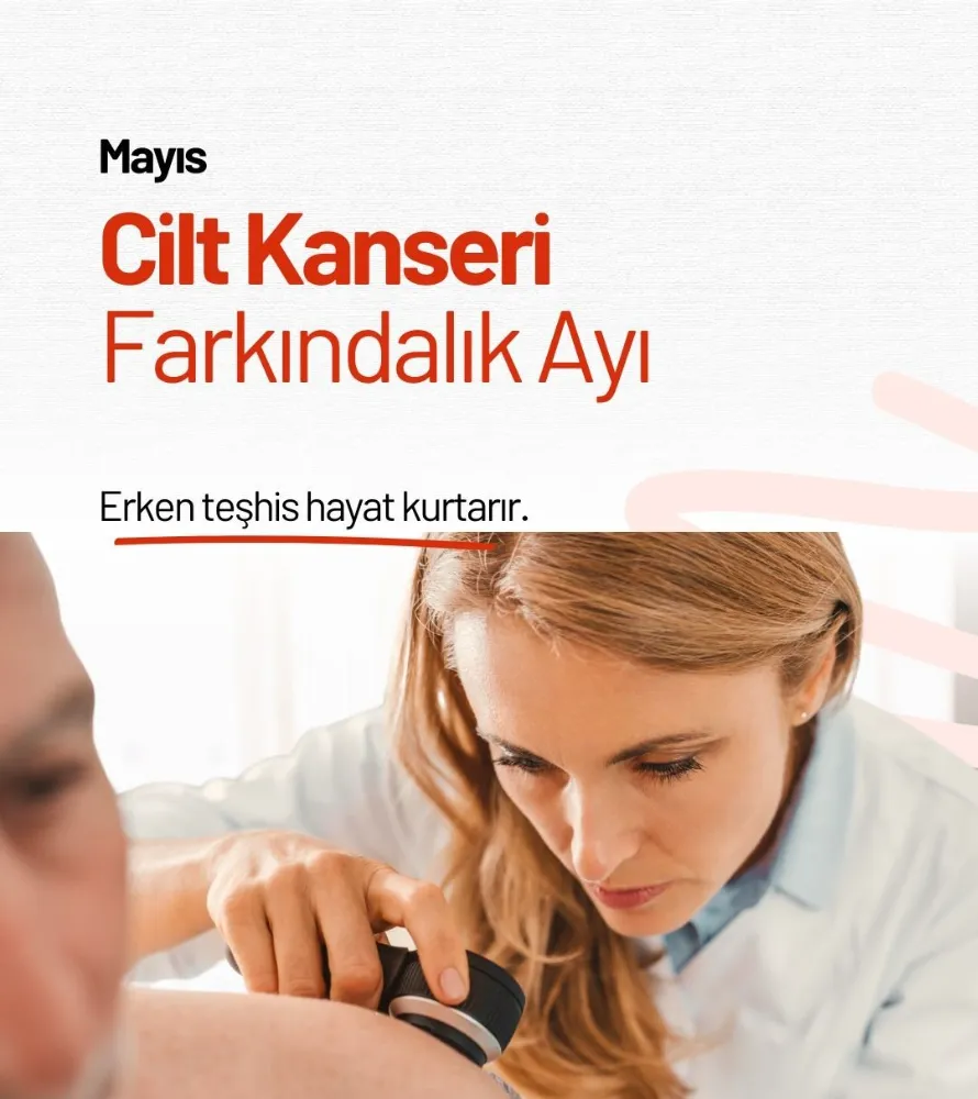 Trabzon İl Sağlık Müdürlüğü’nden Cilt Sağlığına Çağrısı