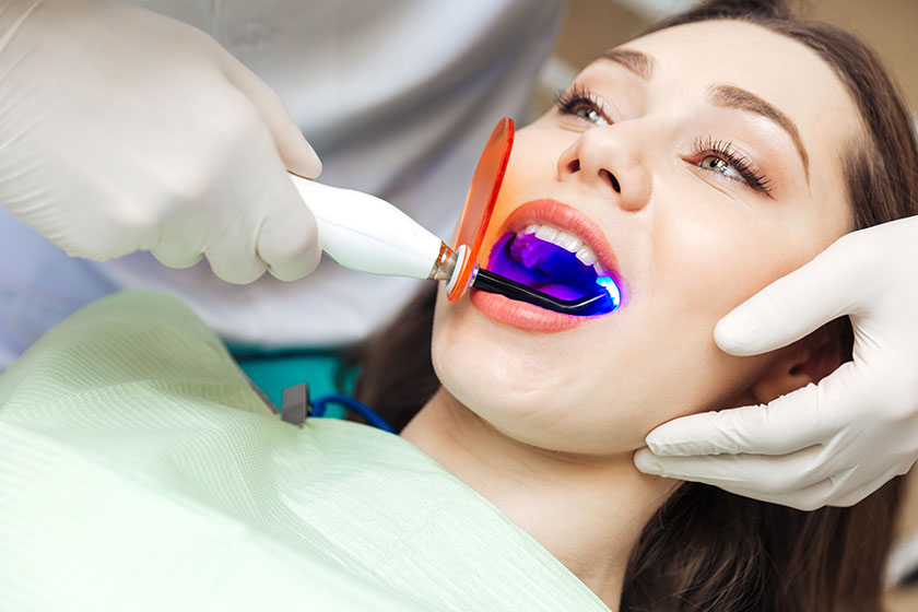 Bleaching Yöntemi Nedir? Diş Beyazlatma Yöntemi Nasıl Yapılır? Bleaching Yöntemi Dişlere Zarar Verir mi?