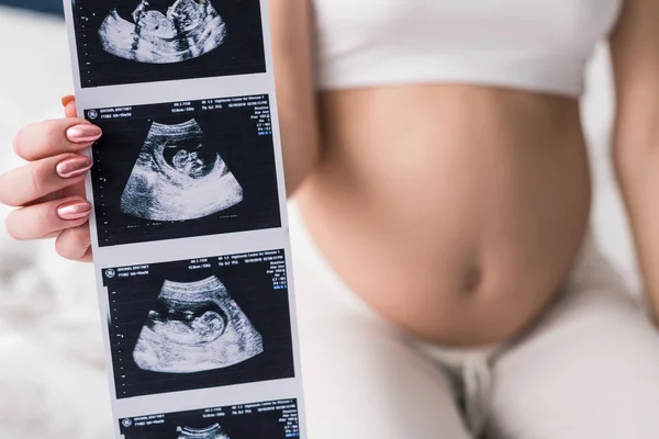 Hamileyken Korunmak Gerekir mi? Hamileyken Tekrar Hamile Kalmak Mümkün mü?