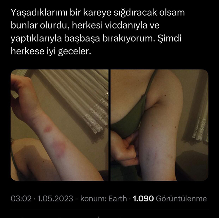 Zonguldak’ta Cinsel birlikteliği kabul etmedi! Saldırıya uğradı